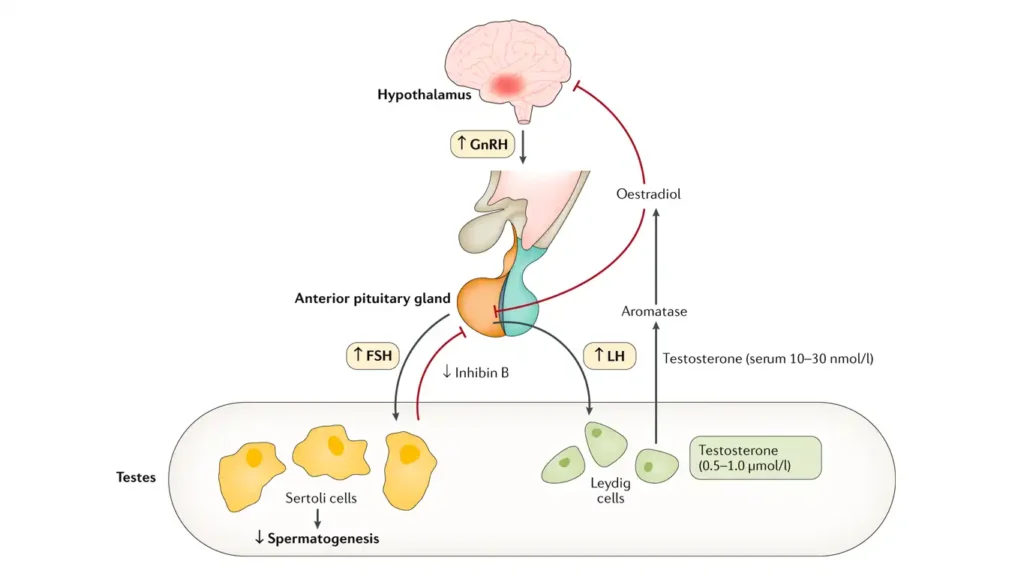 Diagram explaining primary and secondary hypogonadism causes.