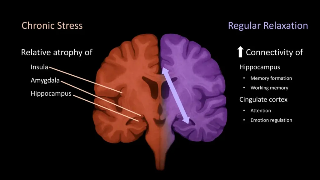 Illustration showing the difference between a stressed brain causing erectile dysfunction and a relaxed brain